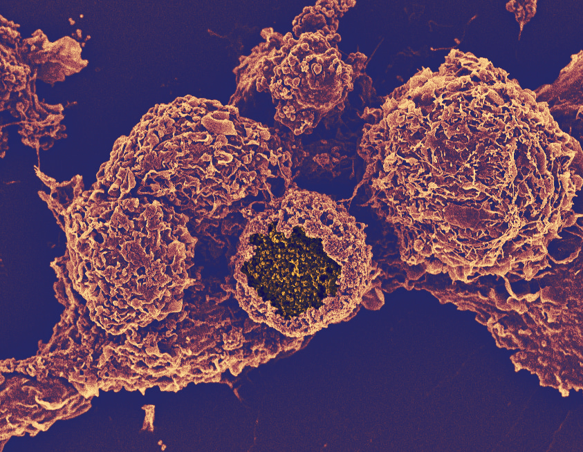Mysteries of Chlamydia-macrophage relationship revealed using stem cells and CRISPR